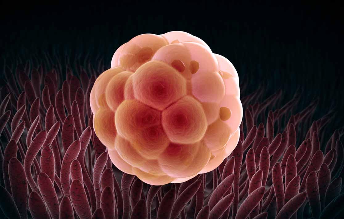 Exti Embryo Εμφύτευση εμβρύου | Διαδικασία & προβλήματα